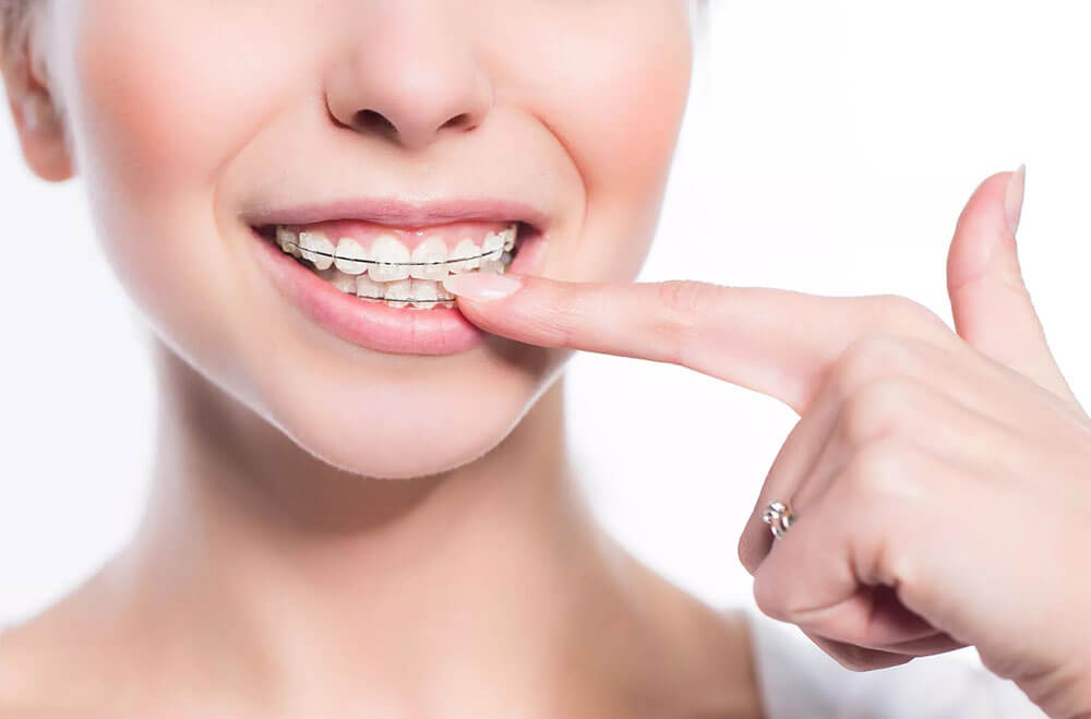 Dental Braces Kemptville