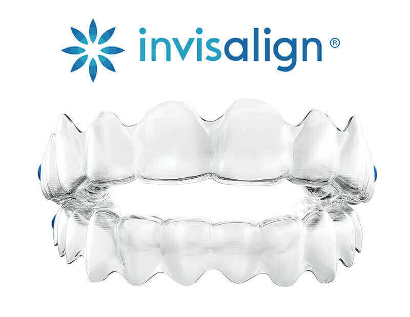 Invisalign Kemptville